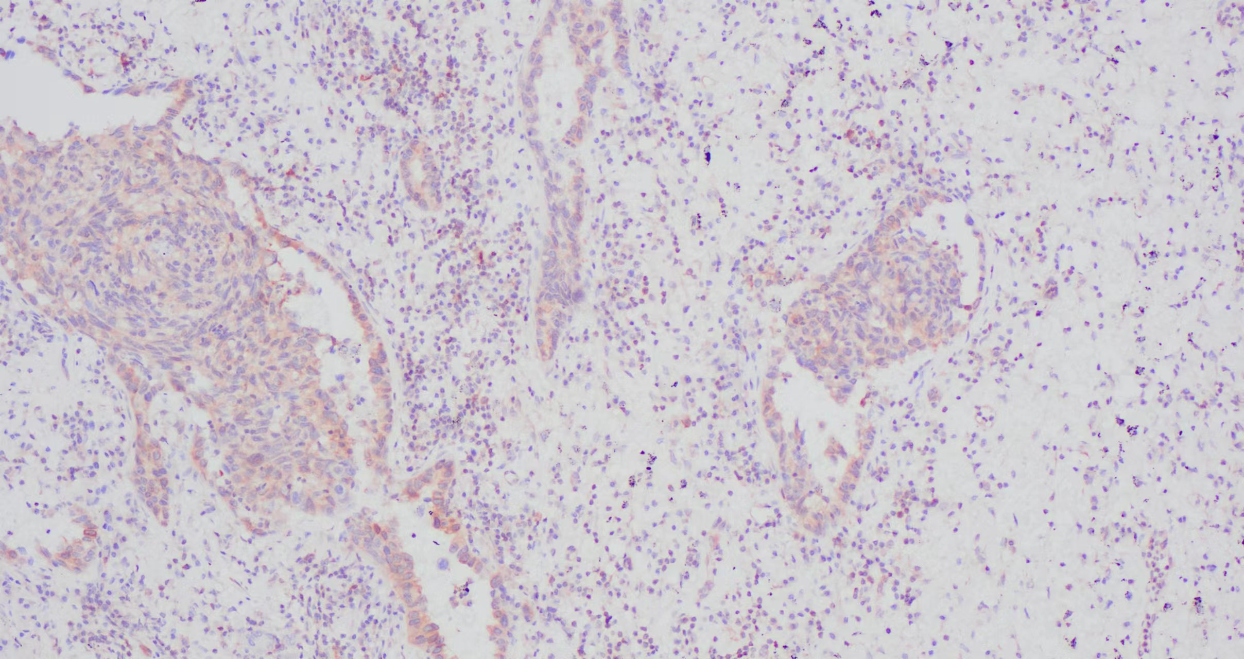 IKBA  �ΰ���֯2.jpg